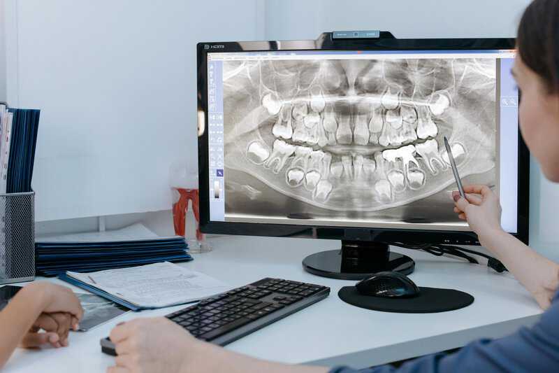 Revolutionizing Dental Care with 3D Dental Technology