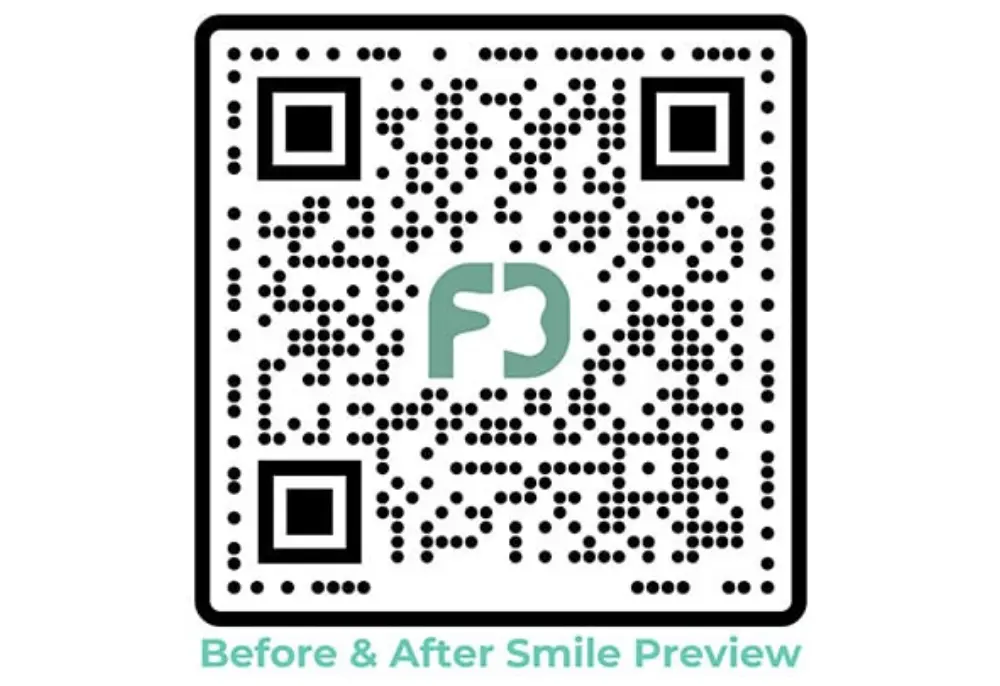 Get a veneers smile preview